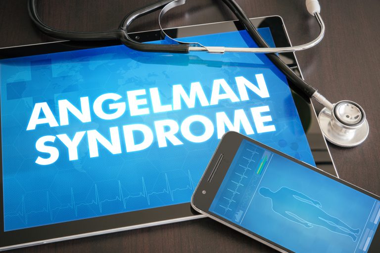 Angelman Syndrome