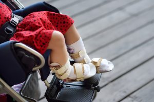 Read more about the article Cerebral Palsy PEDS