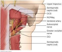 Cervicogenic Headache