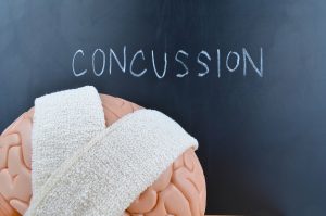 Read more about the article Concussion