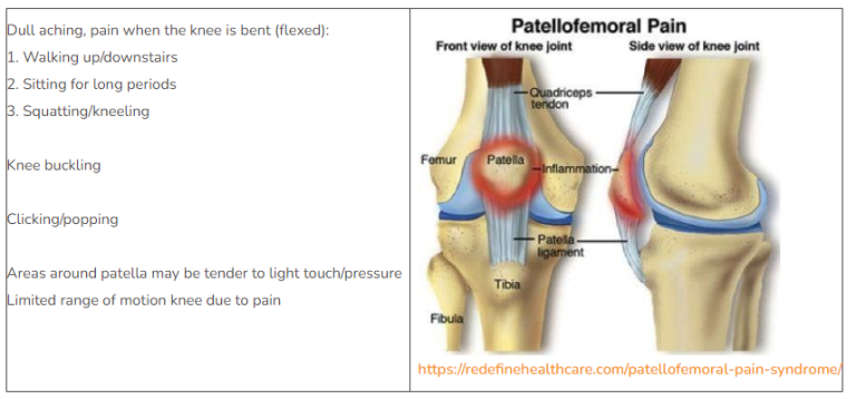 Patellofemoral Syndrome - Kinetic Physical Therapy