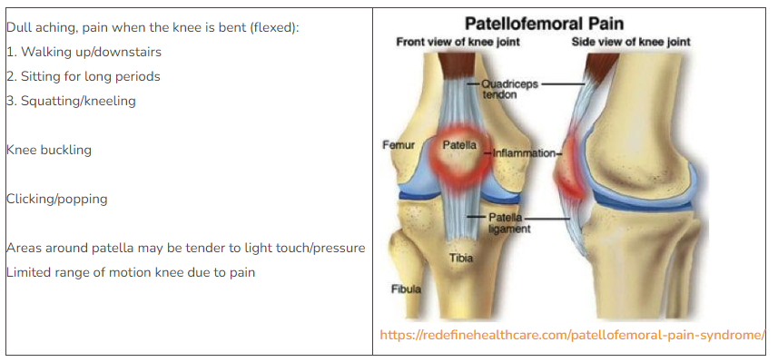 Patellofemoral Syndrome (PFPS)