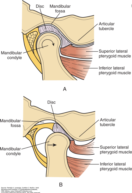 TMJ Syndrome