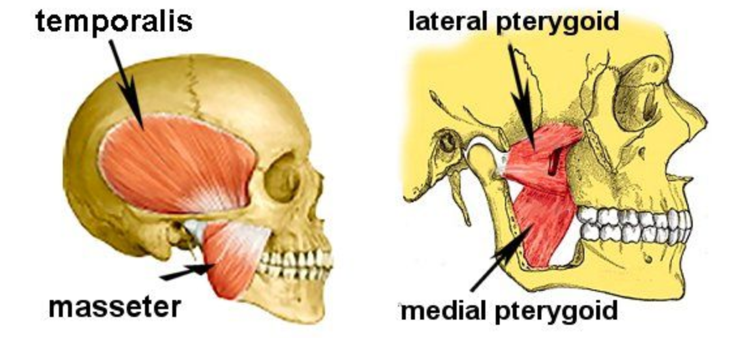 TMJ Syndrome