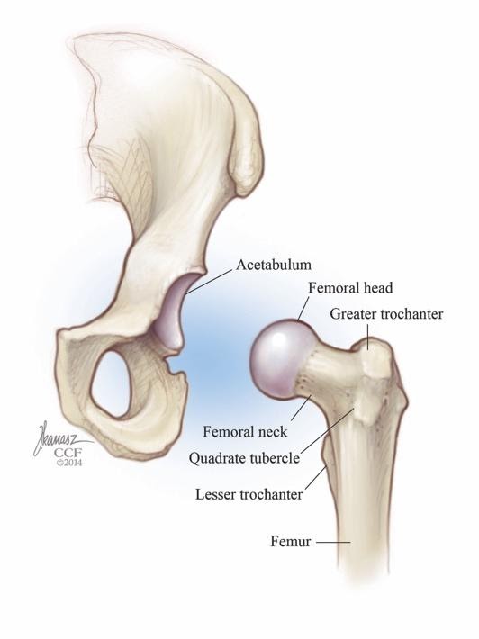 Trochanteric Bursitis